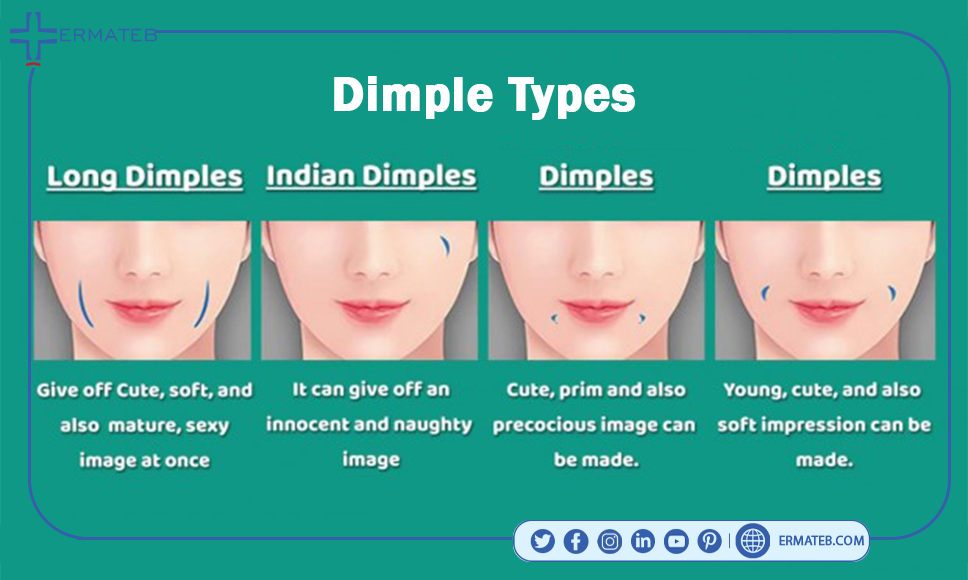 Types of dimples